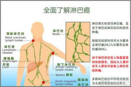 脖子淋巴癌早期症状图片淋巴结节,脖子淋巴癌早期症状解析与数据整合实施方案探讨,深入执行方案设计_RemixOS33.99.66