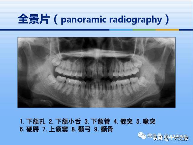 慢性根尖牙周炎怎么治疗