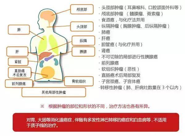 最好的肿瘤医院排名第一