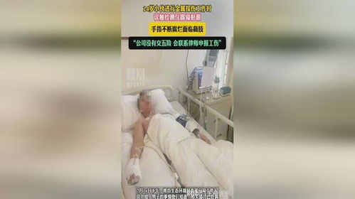 24岁小伙上班6天误触辐射源即将截肢